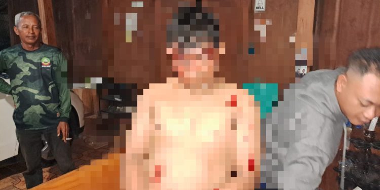 Pria Warga Cepu Mencuri di Warung Blora Babak Belur Diamuk Massa