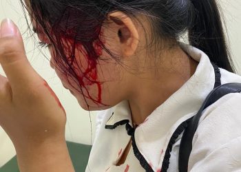 Viral! Karyawati Toko Roti di Penggilingan Jakarta Timur Bersimbah Darah Dihajar dan Dilempar Kursi Oleh Anak Bos