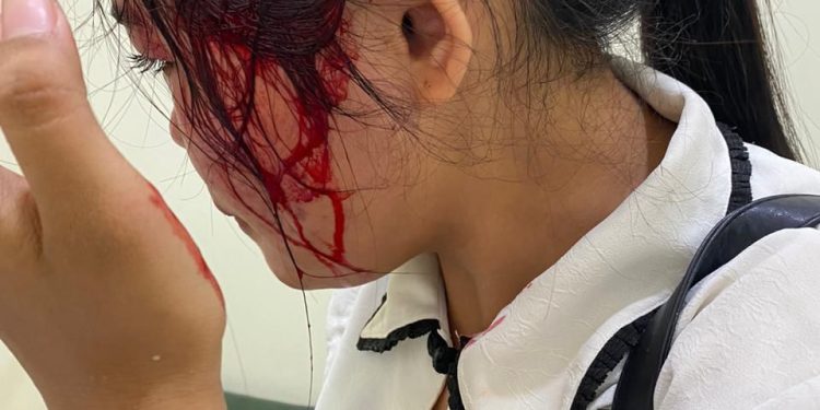 Viral! Karyawati Toko Roti di Penggilingan Jakarta Timur Bersimbah Darah Dihajar dan Dilempar Kursi Oleh Anak Bos