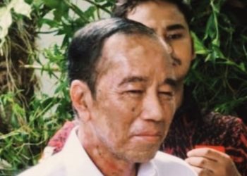 Mantan Presiden RI Joko Widodo sakit (dok. istimewa)