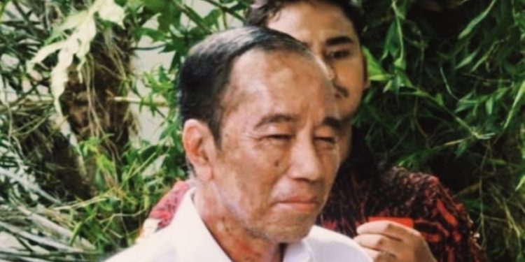Mantan Presiden RI Joko Widodo sakit (dok. istimewa)